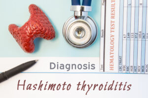 hashimoto-thyroiditis-diagnosis